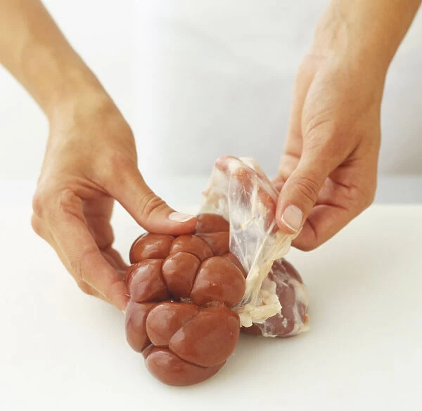 Peeling membrane off whole kidney
