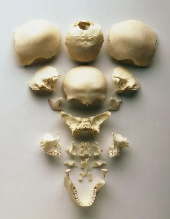 Framed Print : Human Skull Disarticulated Print Framed Print : Human Skull Disarticulated Print