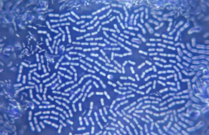 Framed Print : Bacteria Colony Microscope Print Framed Print : Bacteria Colony Microscope Print