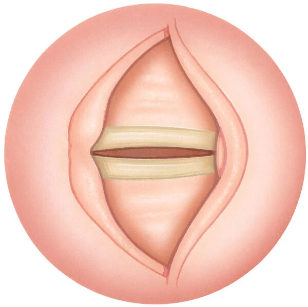 Illustration of closed human vocal fold also known as vocal cord