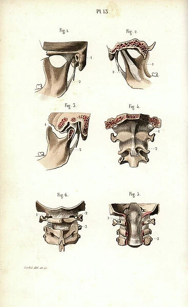 Bone of the jaw and neck. Lithograph of Corbie, in Petity Atlas complet d'Anatomie descriptive du Corps Humain, by Dr. Joseph Nicolas Masse, published by Mequignon Marvis, Paris (France), 1864