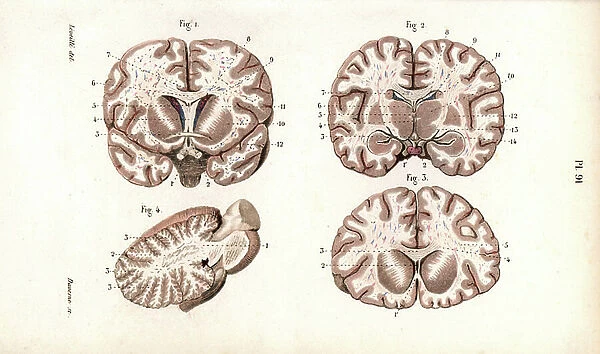 Brain sections. Lithograph by Davesne, based on a drawing by Leveille, in Petity Atlas complet d'Anatomie descriptive du Corps Humain, by Dr. Joseph Nicolas Masse, published by Mequignon Marvis, Paris (France), 1864