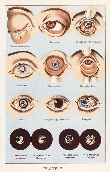 Diseases of the Eye (colour litho)