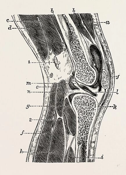 vertical section of knee-joint, medical equipment, surgical instrument, history of