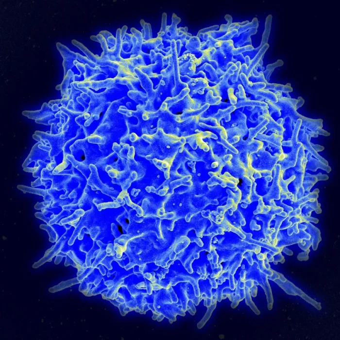Framed Print : Scanning Electron Micrograph Print of a Human T Cell Framed Print : Scanning Electron Micrograph Print of a Human T Cell