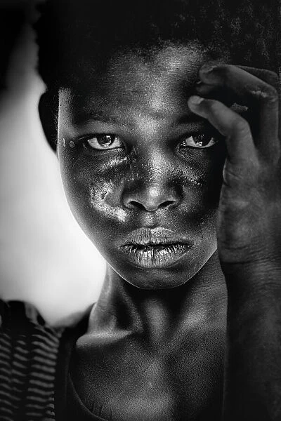 Scarred girl - Benin (Africa)