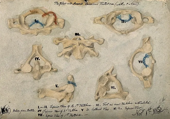 Framed Print : Cervical Vertebrae Print, 1852 Framed Print : Cervical Vertebrae Print, 1852