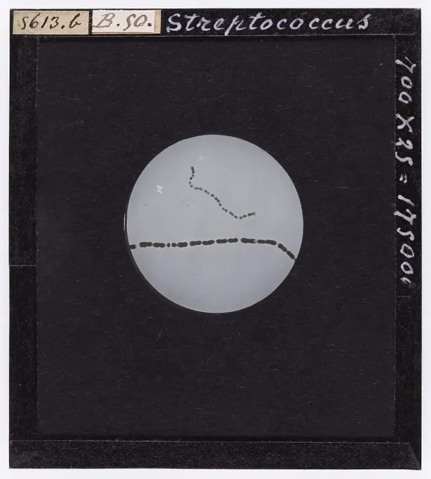 Framed Print : Streptococcus: bacteria enlarged under a microscope