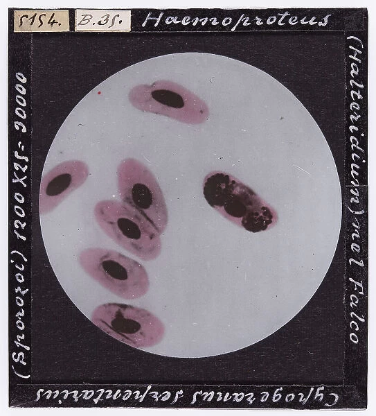 Miocroscopic enlargement of Sporozoi, parasite protozoans