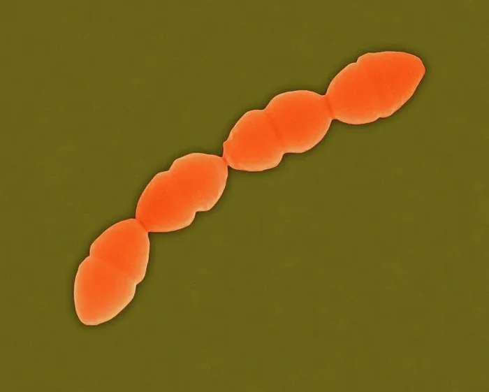 Framed Print : Print of Coloured SEM Image of Dividing Streptococcus pneumoniae Bacteria Framed Print : Print of Coloured SEM Image of Dividing Streptococcus pneumoniae Bacteria