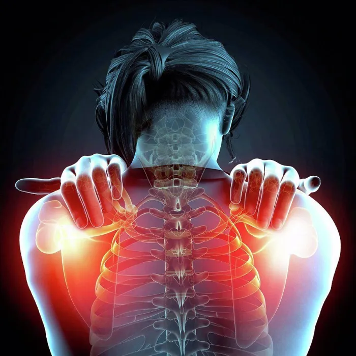Framed Print : Shoulder Pain Print Framed Print : Shoulder Pain Print