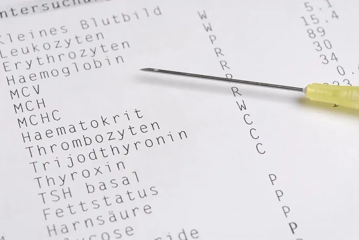 Framed Print : Blood Test Print: Laboratory Analysis