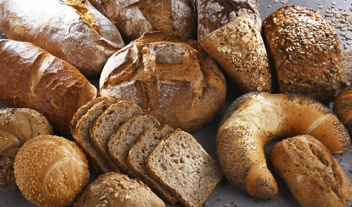 Framed Print : Assorted Bakery Products Print Framed Print : Assorted Bakery Products Print