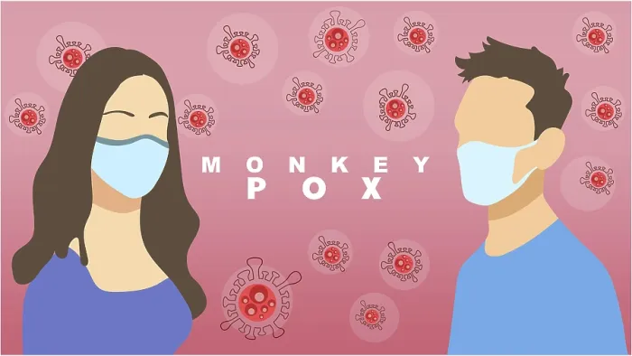 Framed Print : Monkeypox Virus Print Conceptual Design Framed Print : Monkeypox Virus Print Conceptual Design