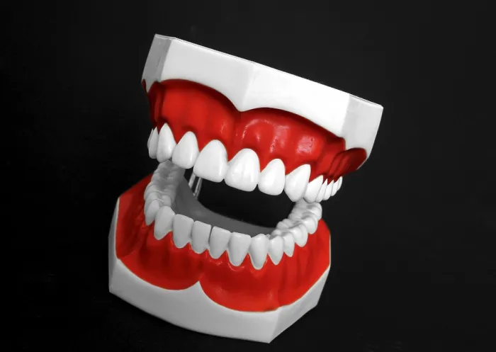 Framed Print : Denture Model Print Framed Print : Denture Model Print