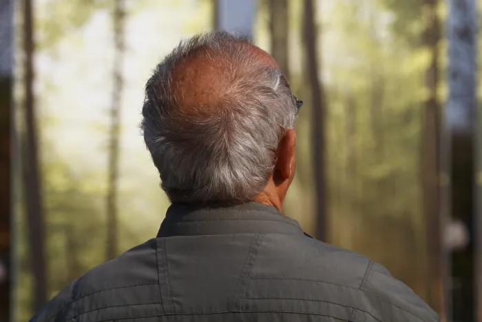 Framed Print : Elderly Man Print - Head Seen from Behind Framed Print : Elderly Man Print - Head Seen from Behind