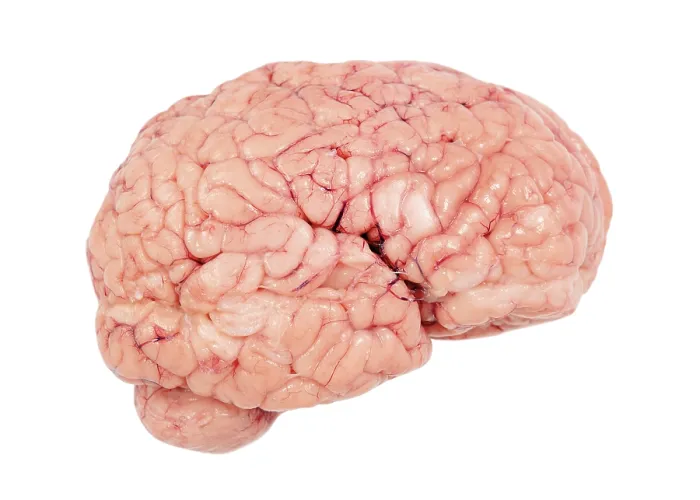 Framed Print : Human Brain, Cut Out Print Framed Print : Human Brain, Cut Out Print