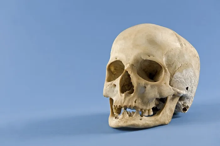 Framed Print : Human Skull Print Framed Print : Human Skull Print