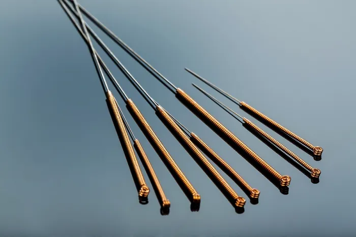 Framed Print : Acupuncture Needles Print - Traditional Chinese Medicine Framed Print : Acupuncture Needles Print - Traditional Chinese Medicine