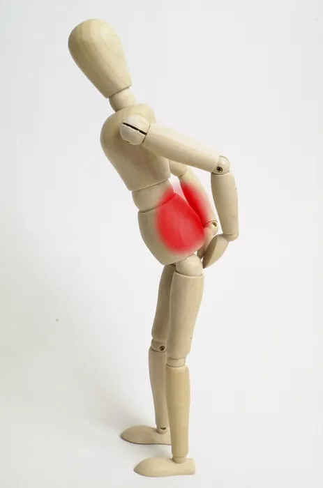 Framed Print : Print of a person experiencing lower back pain Framed Print : Print of a person experiencing lower back pain