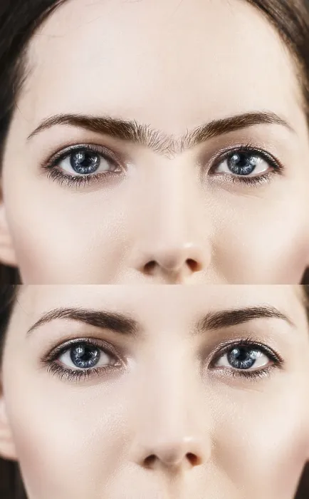 Framed Print : Perfect Eyebrows Before and After Correction Print Framed Print : Perfect Eyebrows Before and After Correction Print