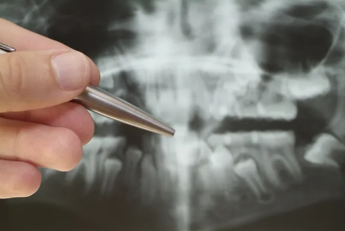 Framed Print : Radiograph Print - Medical Imaging Framed Print : Radiograph Print - Medical Imaging