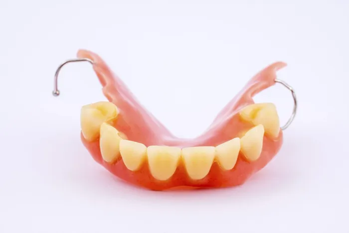 Framed Print : Removable Denture of Upper Jaw Print Framed Print : Removable Denture of Upper Jaw Print