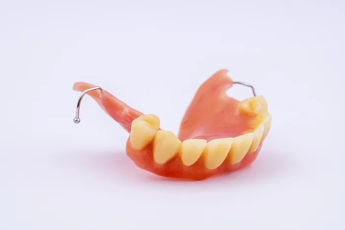 Framed Print : Upper Jaw Removable Denture Print Framed Print : Upper Jaw Removable Denture Print