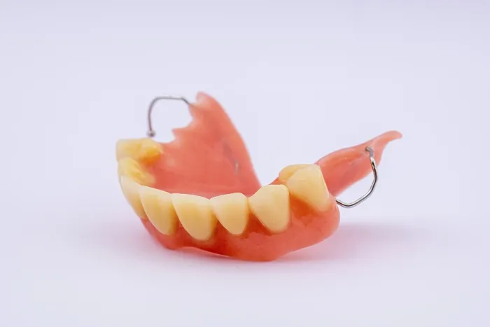 Framed Print : Removable Denture of Upper Jaw Print Framed Print : Removable Denture of Upper Jaw Print