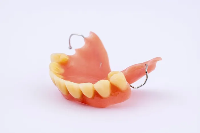 Framed Print : Removable Denture of Upper Jaw Print Framed Print : Removable Denture of Upper Jaw Print