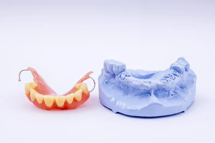 Framed Print : Removable Denture of Upper Jaw Print Framed Print : Removable Denture of Upper Jaw Print