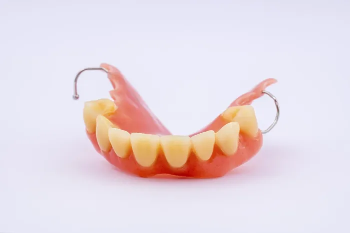 Framed Print : Removable Denture of Upper Jaw Print Framed Print : Removable Denture of Upper Jaw Print