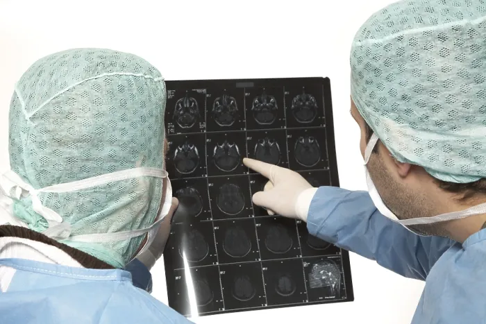 Framed Print : Team of doctors analyzing a CT scan image Print Framed Print : Team of doctors analyzing a CT scan image Print