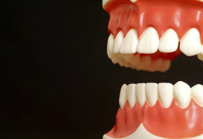 Framed Print : Print of Human Teeth by imageBROKER Framed Print : Print of Human Teeth by imageBROKER