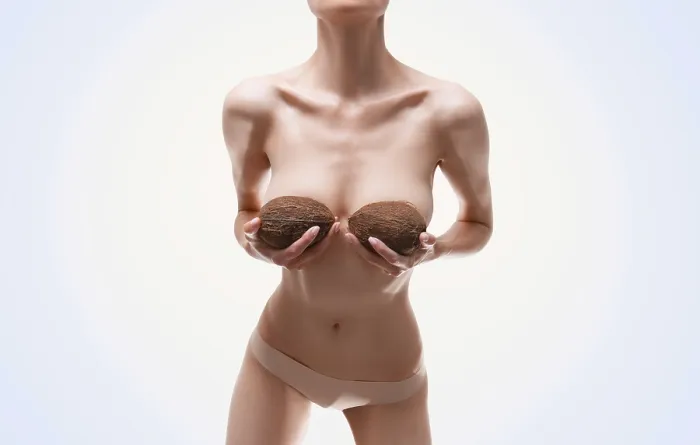 Framed Print : Woman with Coconuts and Silicone Implants Print Framed Print : Woman with Coconuts and Silicone Implants Print