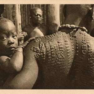 Bamum Woman - Cameroon - Extensive back scarification
