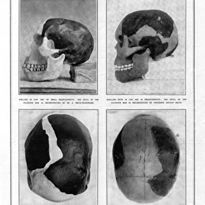 Piltdown Man: reconstructed skulls compared