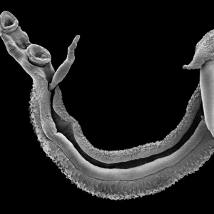 Schistosoma spp. blood fluke