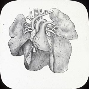 X-Ray - Heart and Lungs