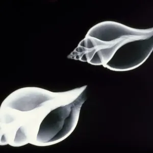 Coquillages - radiographie.