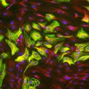 Astrocyte brain cells, light micrograph