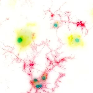 Brain cells, light micrograph