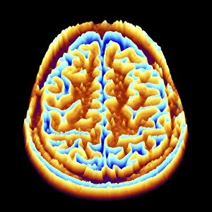 Brain scan, MRI scan, heightmap F006 / 7096