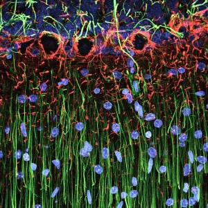 Cerebellum Tissue Print, Confocal Light Micrograph Cerebellum Tissue Print, Confocal Light Micrograph