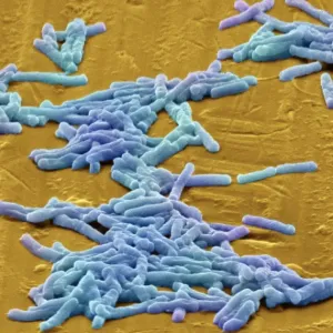 SEM Print of Clostridium difficile bacteria, coloured SEM Print of Clostridium difficile bacteria, coloured