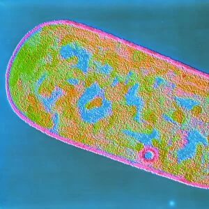 Clostridium perfringens bacterium