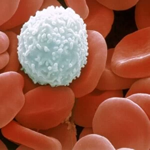 Colour SEM of red & white blood cells