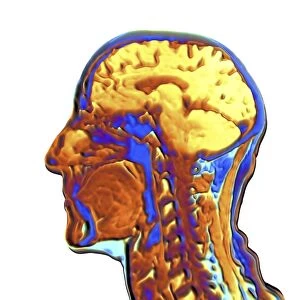 Coloured MRI scan of the human head F006 / 9210