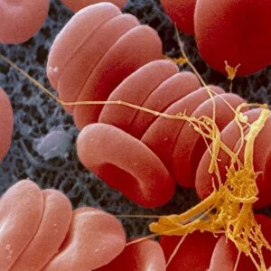 Coloured SEM of an early blood clot forming