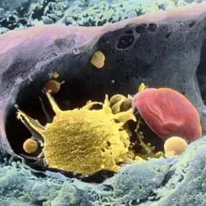 Coloured SEM of a monocyte in a blood capillary